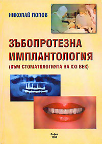 корица - Зъбопротезна имплантология